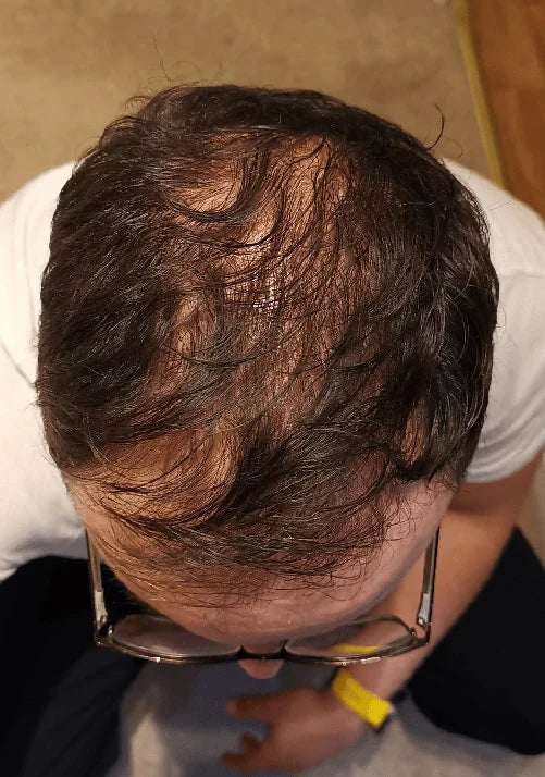 Înainte de utilizare