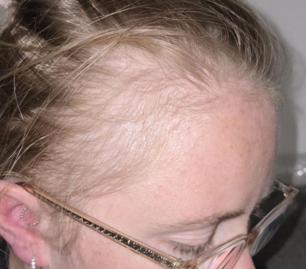 Înainte de utilizare