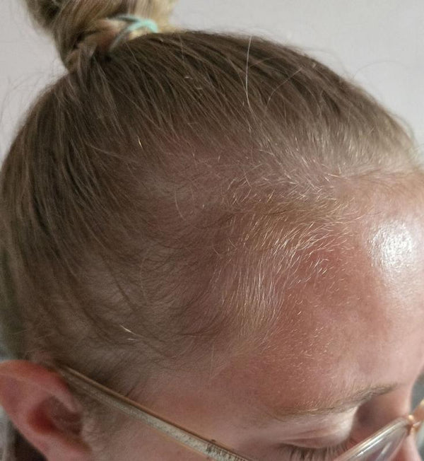 După approx. 4 luni