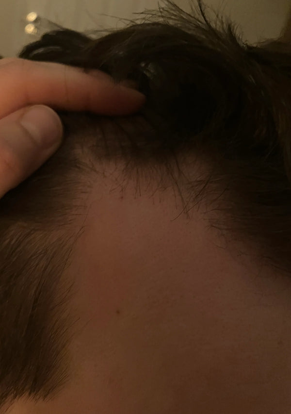 Înainte de utilizare