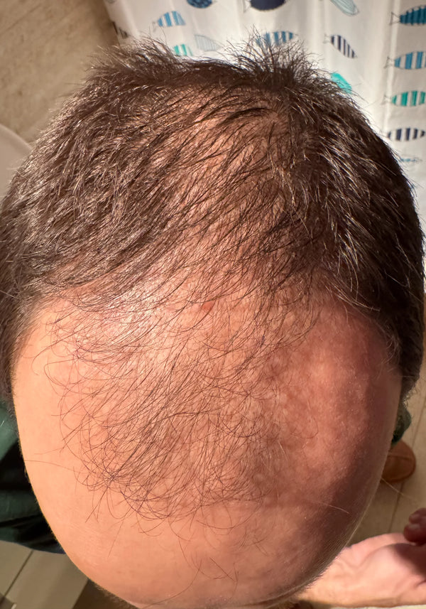 Înainte de utilizare