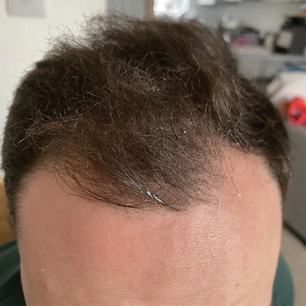 Înainte de utilizare