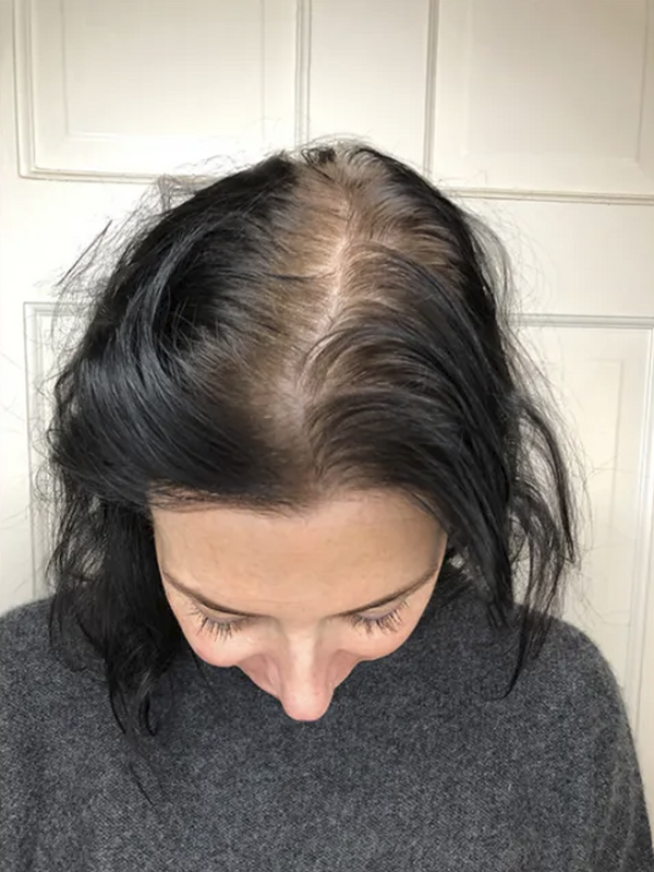 Înainte de utilizare