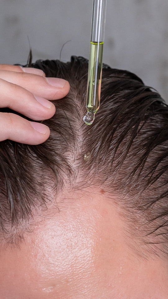 Bundle Folifort™ – Bărbați